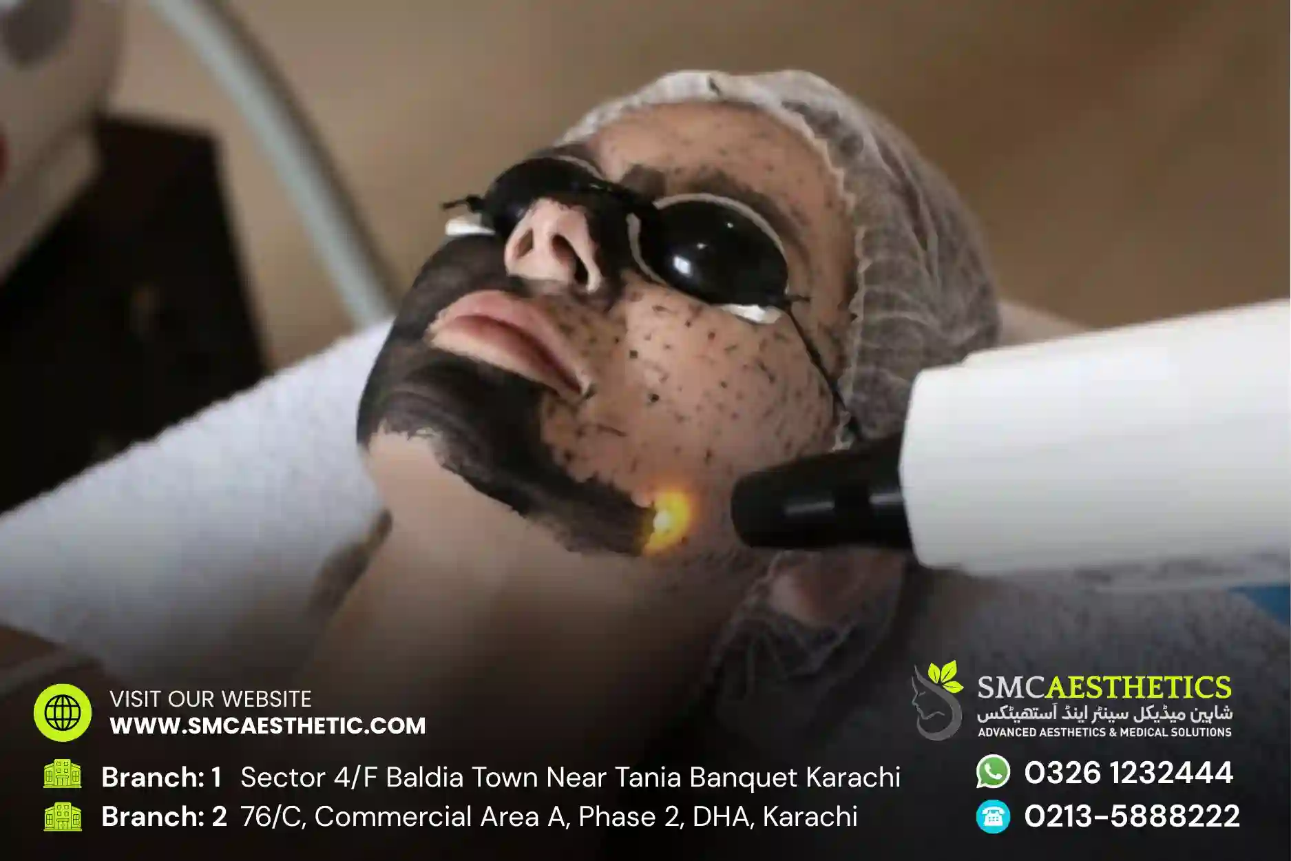 Carbon Facial Treatment in Karachi - Laser Carbon Peel at SMC Aesthetics